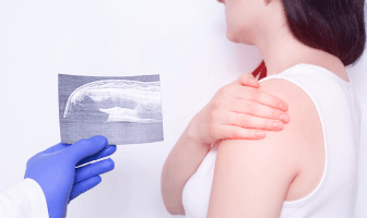 ankylosing-spondylitis_2.png