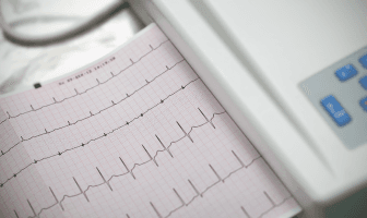 atrial fibrillation_2.png
