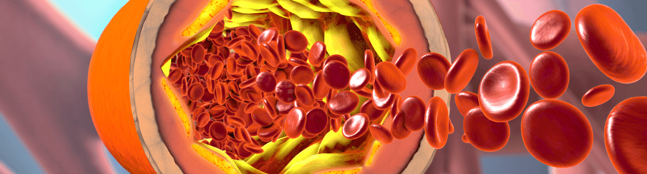 dyslipedimia (2).png